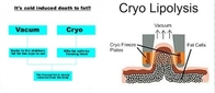 공장 가격!!! 기계를 체중을 줄이는 새로운 Cryolipolysis RF 공동현상 진공